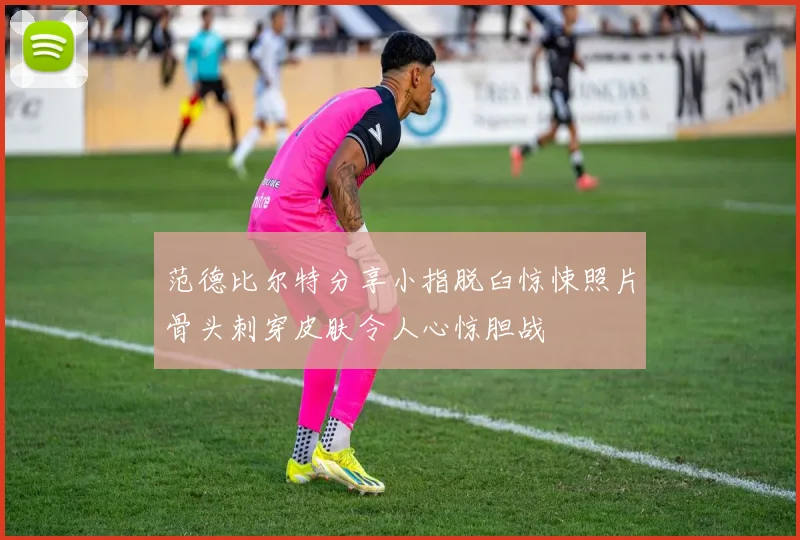 范德比尔特分享小指脱臼惊悚照片骨头刺穿皮肤令人心惊胆战